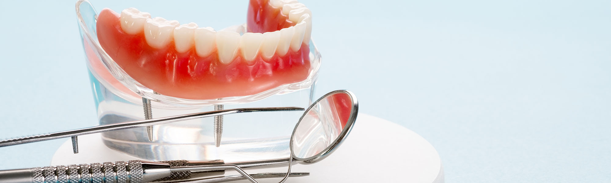 Restoring Missing Teeth: Dentures vs Implants Downey CA