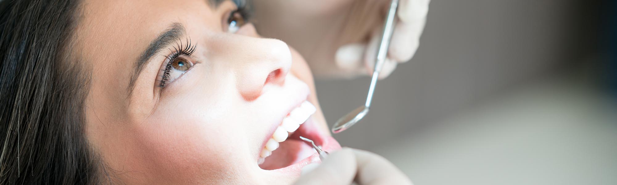 Routine Teeth Cleaning Downey CA