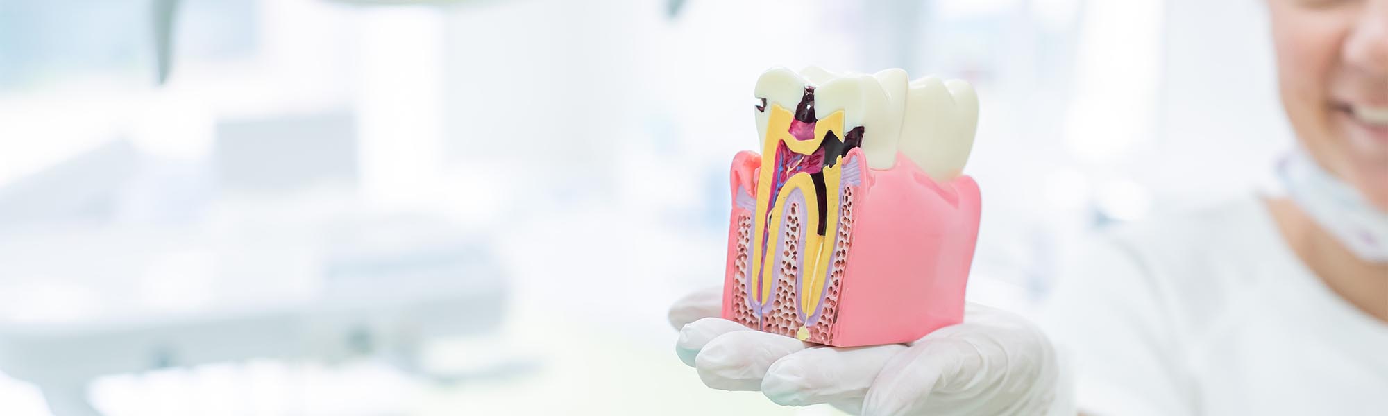 Dental Abrasion in Downey CA
