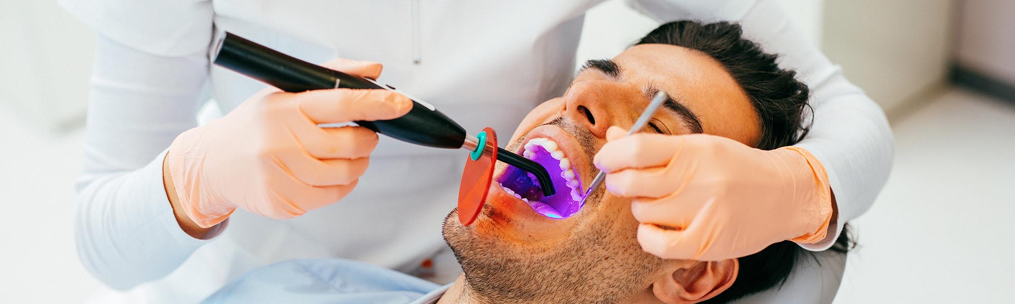 Dental Sealants Downey CA