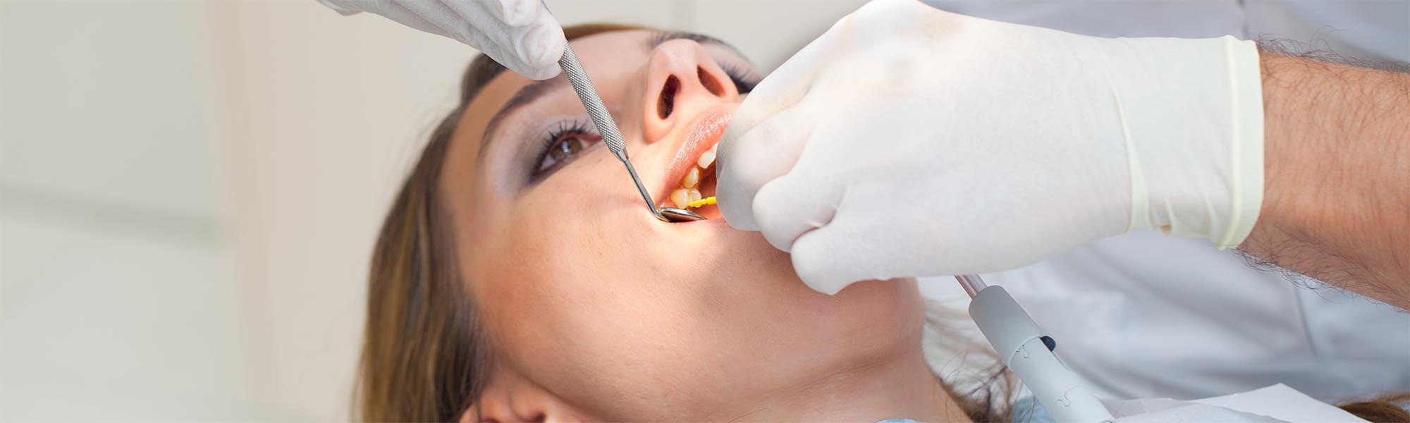 Wisdom Tooth Removal in Downey CA